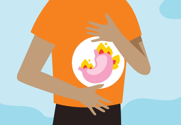 Acid Reflux and Ayurveda